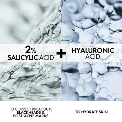 Vichy Face Cream for Acne-Prone Skin, Normaderm Double-Action Anti-Acne Face Moisturizer with Salicylic Acid, Oil-Free, Non-Comedogenic, Hypoallergenic, & Paraben-Free, 50mL 🍁 All In One Marketplace Canada