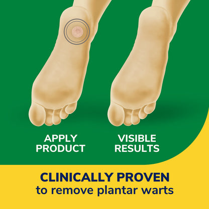 Dr. Scholl's Clear Away Wart Remover Plantar Wart,24 Count 🍁 All In One Marketplace Canada