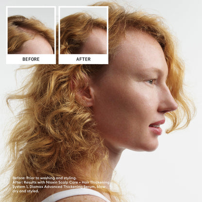 Nioxin System 1 Scalp + Hair Thickening Shampoo | For Natural Hair with Light Thinning | Strengthen Against Breakage with Niacinamide & Biotin | 33.8 Fl Oz 🍁 All In One Marketplace Canada
